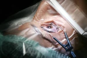 Una mujer italiana recupera la vista tras un trasplante sin precedentes